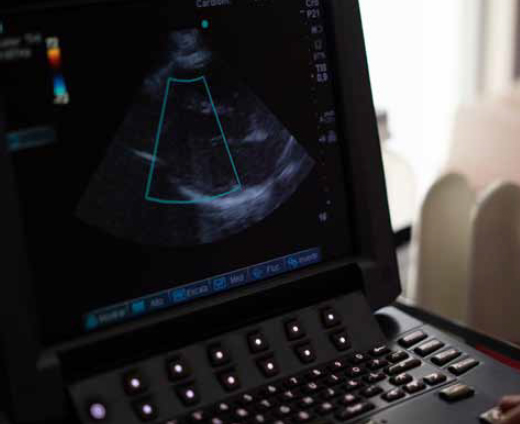 L’Intelligenza Artificiale applicata all’Ecocardiografia Clinica