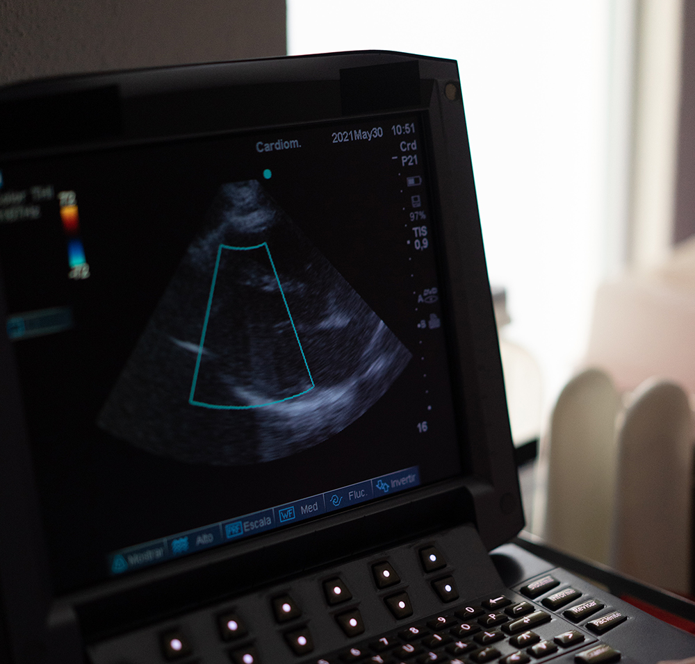 L’ecocardiografia clinica implementata con algoritmi di Intelligenza Artificiale: la realtà lavorativa del Centro cardiologico Spoke