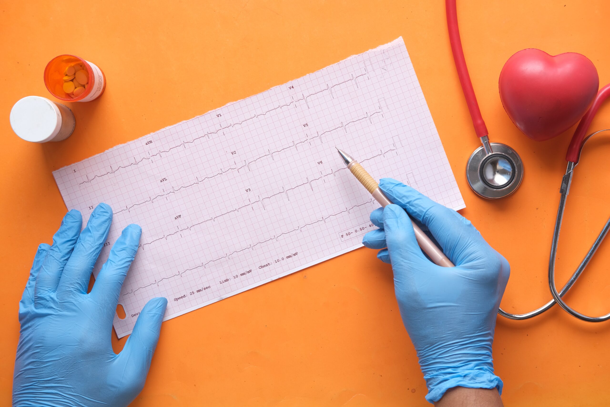 Schemi gestionali delle aritmie nel cardiopatico congenito adulto