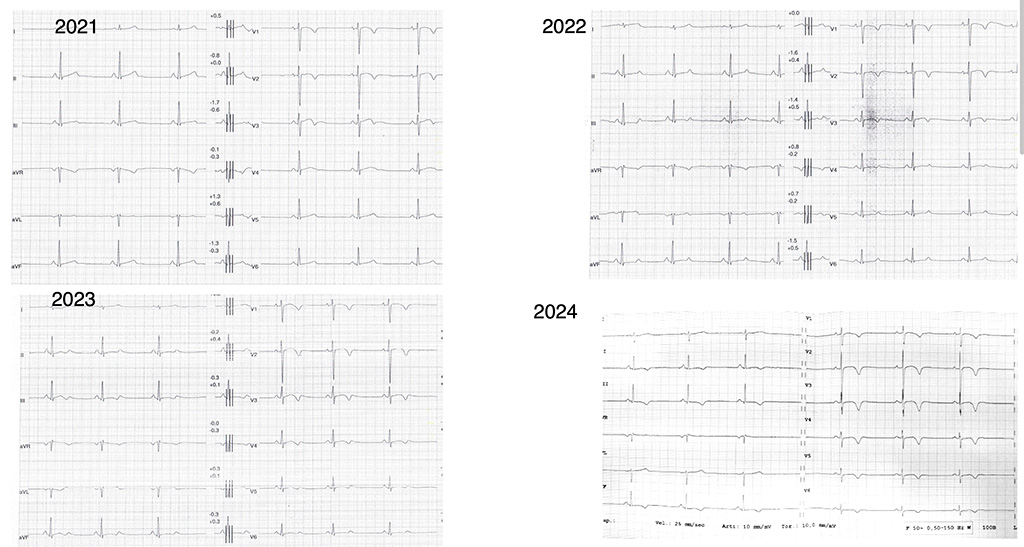 Quella che poteva essere l’ultima vetta