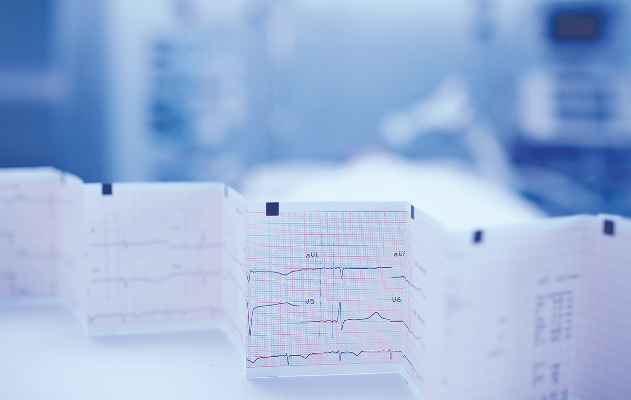 La Sindrome Coronarica Cronica: dietro le quinte dell’emodinamica