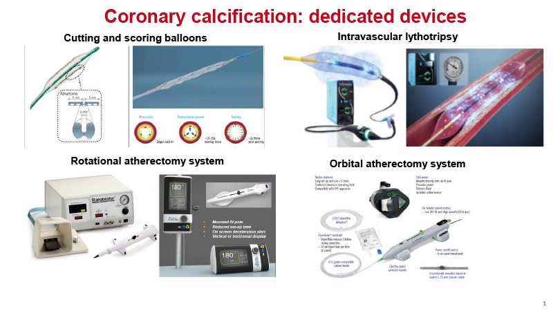 Il trattamento percutaneo delle lesioni coronariche calcifiche L’esperienza della Regione Molise